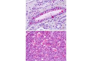 Immunohistochemical staining of formalin-fixed, paraffin-embedded human tonsil with LPHN3 polyclonal antibody . (LPHN3 Antikörper  (C-Term))