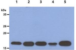 The Cell lysates (40ug) were resolved by SDS-PAGE, transferred to PVDF membrane and probed with anti-human ACP1 antibody (1:1000). (ACP1 Antikörper)