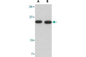 Western blot analysis of POFUT1 in human heart tissue lysate with POFUT1 polyclonal antibody  at (A) 0. (POFUT1 Antikörper  (N-Term))