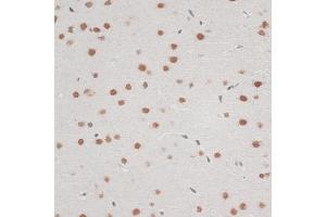 Immunohistochemistry of paraffin-embedded mouse brain using ZNF148 antibody (ABIN6130815, ABIN6150463, ABIN6150464 and ABIN6222770) at dilution of 1:100 (40x lens). (ZNF148 Antikörper  (AA 690-794))