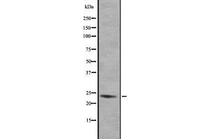 Western blot analysis of GEM expression in 293 lysate,The lane on the left is treated with the antigen-specific peptide. (GEM Antikörper  (N-Term))