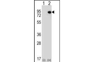 Western blot analysis of ELF4 (arrow) using rabbit polyclonal ELF4 Antibody (N-term) (ABIN656688 and ABIN2845925). (Elf4 Antikörper  (N-Term))