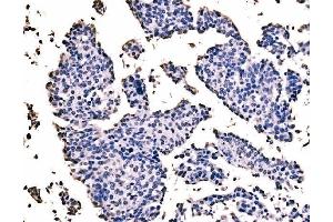 IHC analysis of splicing factor 1 using anti-splicing factor 1 antibody (ABIN7600194). (Splicing Factor 1 Antikörper  (AA 160-266))