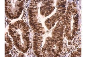 Immunohistochemistry (IHC) image for anti-Growth Factor Receptor-Bound Protein 2 (GRB2) (C-Term) antibody (ABIN2854697)