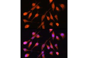 Immunofluorescence (IF) image for anti-Protein Phosphatase, Mg2+/Mn2+ Dependent, 1A (PPM1A) (AA 1-382) antibody (ABIN6146039)