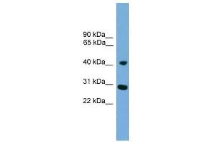 CRLS1 antibody used at 0. (CRLS1 Antikörper  (Middle Region))