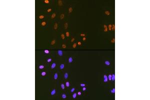 Immunofluorescence analysis of C6 cells using DNA Ligase I Rabbit mAb (ABIN7268251) at dilution of 1:100 (40x lens). (LIG1 Antikörper)