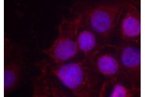 Immunofluorescence analysis of methanol-fixed MCF-7 cells using Phospho-Estrogen Receptor alpha(S118) Polyclonal Antibody (Estrogen Receptor alpha Antikörper  (pSer118))