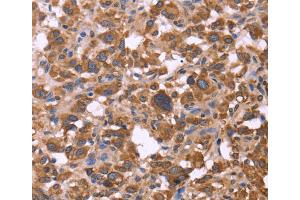 Immunohistochemistry (IHC) image for anti-F-Box and WD Repeat Domain Containing 7 (FBXW7) antibody (ABIN2429748) (FBXW7 Antikörper)