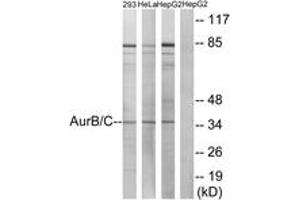 Western blot analysis of extracts from 293/HeLa/HepG2 cells, treated with Paclitaxel 1uM 24h, using AurB/C (Ab-202/175) Antibody. (AurB/C Antikörper  (AA 201-250))