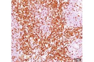 IHC testing of human tonsil (10X) stained with CD6 antibody cocktail (C6/372 + 3F7B5). (CD6 Antikörper)