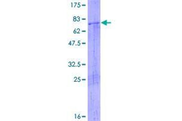 ATAD2 Protein (GST tag)