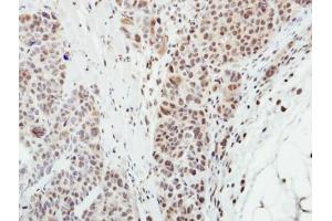 Immunohistochemistry (IHC) image for anti-Membrane Protein, Palmitoylated 3 (MAGUK P55 Subfamily Member 3) (MPP3) (Center) antibody (ABIN2856515)