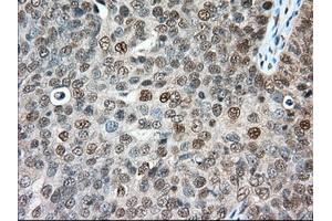 Immunohistochemical staining of paraffin-embedded Human colon tissue using anti-ERCC1 mouse monoclonal antibody. (ERCC1 Antikörper)