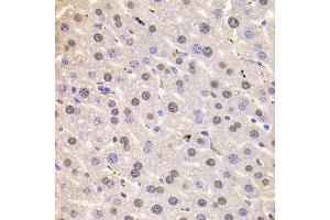 Immunohistochemistry of paraffin-embedded Mouse liver using HNRNPD antibody at dilution of 1:100 (x400 lens). (HNRNPD/AUF1 Antikörper)