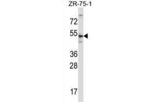Western Blotting (WB) image for anti-Telomeric Repeat Binding Factor 2 (TERF2) antibody (ABIN2997581) (TRF2 Antikörper)