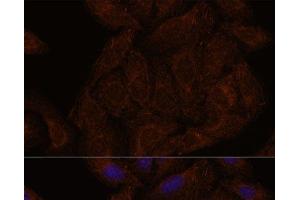 Immunofluorescence analysis of U-2 OS cells using SEPT8 Polyclonal Antibody at dilution of 1:100. (Septin 8 Antikörper)