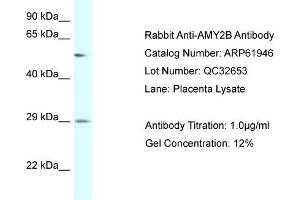 Western Blotting (WB) image for anti-Amylase, alpha 2B (Pancreatic) (AMY2B) (N-Term) antibody (ABIN2774328)