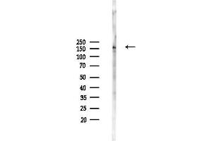 anti-Mitogen-Activated Protein Kinase Kinase Kinase 1 (MAP3K1) (pThr1400) antibody