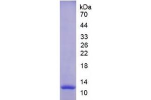 SDS-PAGE (SDS) image for Matrix Metallopeptidase 12 (Macrophage Elastase) (MMP12) ELISA Kit (ABIN6720563)