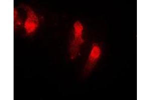 Immunofluorescent analysis of Cystatin B staining in EOC20 cells. (CSTB Antikörper  (Center))
