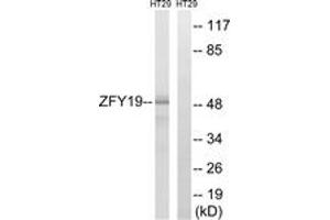 Western blot analysis of extracts from HT-29 cells, using ZFYVE19 Antibody. (ZFYVE19 Antikörper  (AA 311-360))