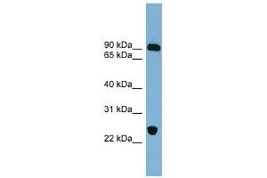 VPS53 antibody used at 1 ug/ml to detect target protein.