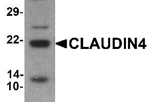 Western blot analysis of CLAUDIN4 in human colon tissue lysate with CLAUDIN4 antibody at 1 µg/mL (Claudin 4 Antikörper  (C-Term))