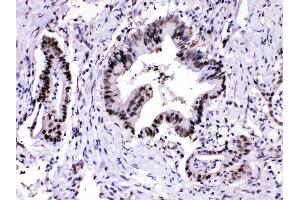 Immunohistochemistry (IHC) image for anti-Proteasome Subunit Alpha Type 3 (PSMA3) (AA 88-127), (Middle Region) antibody (ABIN4886706)