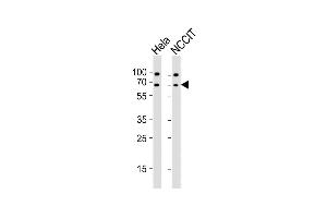 All lanes : Anti-GNL3 Antibody (N-term) at 1:2000 dilution Lane 1: Hela whole cell lysates Lane 2: NCCIT whole cell lysates Lysates/proteins at 20 μg per lane. (Nucleostemin Antikörper  (N-Term))