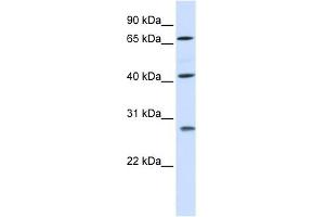 RDM1 antibody used at 1 ug/ml to detect target protein.