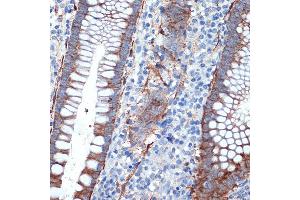 Immunohistochemistry of paraffin-embedded human appendix using Creatine kinase B type (CKB) Rabbit mAb (ABIN7266515) at dilution of 1:100 (40x lens). (CKB Antikörper)