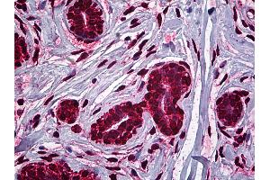 Anti-MDM2 antibody IHC of human breast. (MDM2 Antikörper  (AA 101-201))