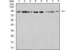 Western blot analysis using KDM1A mouse mAb against SK-Br-3 (1), K562 (2), SW480 (3), Jurkat (4), Hela (5), COS7 (6), T47D (7), and HCT116 (8) cell lysate. (LSD1 Antikörper  (AA 55-263))