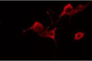 Immunofluorescence (fixed cells) (IF/ICC) image for anti-Amyloid beta (A4) Precursor Protein-Binding, Family B, Member 1 Interacting Protein (APBB1IP) (Internal Region) antibody (ABIN6259973)