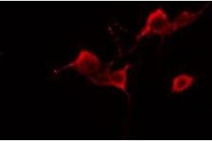 ABIN6277989 staining A549 cells by IF/ICC.