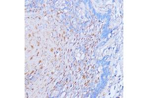 Immunohistochemistry of paraffin-embedded human esophageal using NME6 antibody (ABIN7268942) at dilution of 1:100 (40x lens). (NME6 Antikörper  (AA 9-194))