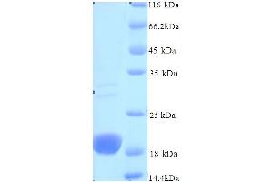 SDS-PAGE (SDS) image for Niemann-Pick Disease, Type C2 (NPC2) (AA 22-149) protein (His tag) (ABIN4975226)
