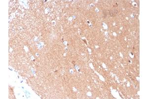 Formalin-fixed, paraffin-embedded human Brain stained with Tubulin beta 3 Mouse Monoclonal Antibody (TUBB3/3731). (TUBB3 Antikörper  (AA 437-450))