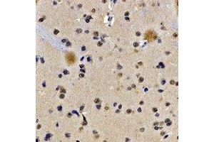 Immunohistochemical analysis of Lamin B Receptor staining in rat brain formalin fixed paraffin embedded tissue section.