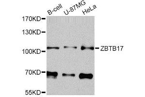 Western blot analysis of extracts of various cell lines, using ZBTB17 Antibody (ABIN5974597) at 1/1000 dilution. (ZBTB17 Antikörper)