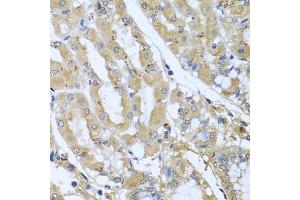 Immunohistochemistry of paraffin-embedded human stomach using STX7 antibody (ABIN6128800, ABIN6148669, ABIN6148670 and ABIN6224079) at dilution of 1:100 (40x lens). (Syntaxin 7 Antikörper  (AA 1-170))