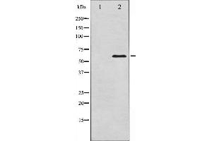 Western blot analysis of Src expression in COLO205 whole cell lysates,The lane on the left is treated with the antigen-specific peptide. (Src Antikörper  (Internal Region))