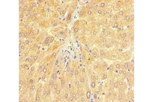 Immunohistochemistry of paraffin-embedded human liver tissue using ABIN7147720 at dilution of 1:100 (CHD4 Antikörper  (AA 1-219))