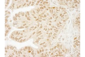 Immunohistochemistry (IHC) image for anti-Ubiquitin Specific Peptidase 15 (USP15) (C-Term) antibody (ABIN7448852) (USP15 Antikörper  (C-Term))