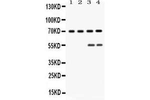 Western blot analysis of YAP1 expression in rat testis extract ( Lane 1), mouse ovary extract ( Lane 2), HELA whole cell lysates ( Lane 3) and MCF-7 whole cell lysates ( Lane 4). (YAP1 Antikörper  (N-Term))