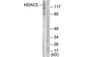 Western Blotting (WB) image for anti-Histone Deacetylase 5 (HDAC5) (AA 1073-1122) antibody (ABIN2889210) (HDAC5 Antikörper  (AA 1073-1122))