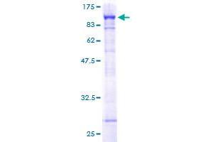 PARN Protein (AA 1-639) (GST tag)