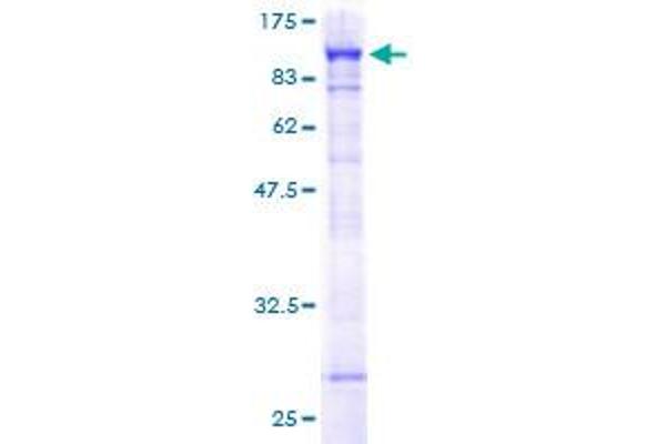 PARN Protein (AA 1-639) (GST tag)