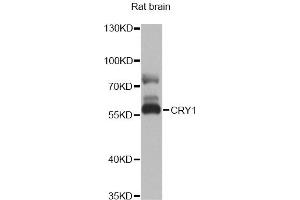 Western blot analysis of extracts of rat brain, using CRY1 antibody. (CRY1 Antikörper)
